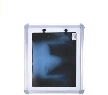 Healthcare Single Film X-Ray View Box Automatic Film And With Dimmer to Adjust Brightness X-Ray Viewer (14 * 17 View Area)