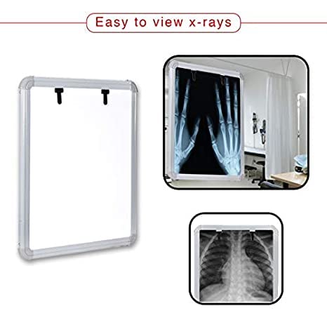 Healthcare Single Film X-Ray View Box Automatic Film And With Dimmer to Adjust Brightness X-Ray Viewer (14 * 17 View Area)